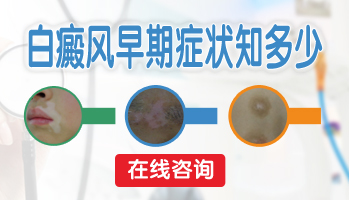 河北白癜风白斑白点图