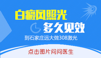 黄豆大白癜风在变大照308激光效果怎么样