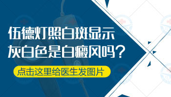 米粒大白癜风一直在变大照308激光好还是311紫外线好