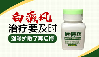 拇指大白癜风在扩散不吃药用仪器治疗能好吗