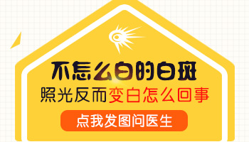 白斑扩散2年了照308nm激光多久能好转