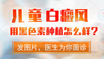 身上的白癜风在变大照激光308好还是uvb效果好