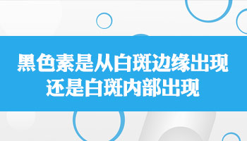 米粒大白癜风一直在变大只吃药不照光多久能好