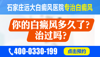 女性额头出现白斑，如何判断是否为白癜风？