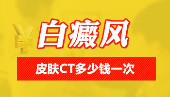 进展期白癜风照308激光3次不见好怎么办