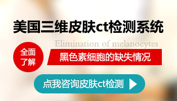 10岁孩子手指有白斑照308激光好还是uvb效果好