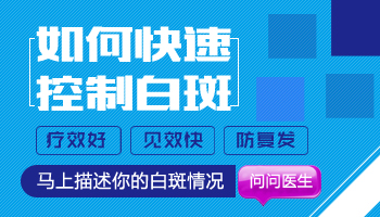 白癜风处在发展期照uvb一个疗程不见好怎么办