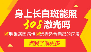 扩散中的白斑照308激光几个疗程能治好