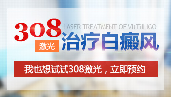 小面积发展期白癜风照308准分子激光多久能好