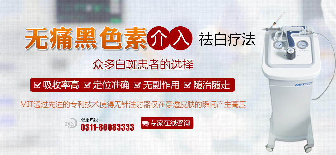 大面积白斑在扩散照进口308激光能治疗好吗