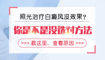 进展期白癜风照进口308激光能治疗好吗