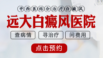 大面积进展期白癜风照308激光几个疗程能治好