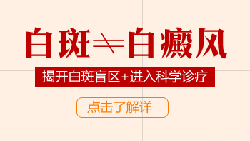 10岁孩子手指有白癜风照308激光大约多长时间能康复