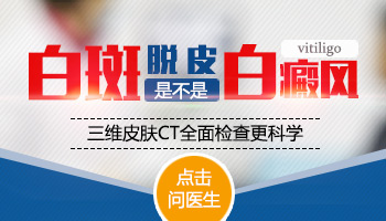 10岁孩子手上长白癜风吃中药治疗需要多久能恢复好