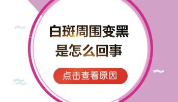 发展期的白癜风中医治疗恢复时间长不长