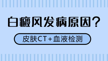 小面积发展期白癜风哪种方法治疗没有副作用