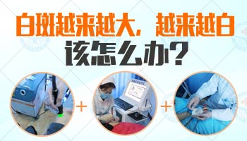 夏季男性白癜风患者适合激光治疗吗？