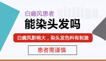 男子手上长白癜风该怎么治疗，有康复案例吗