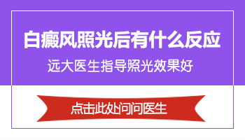 大面积白斑在扩散照进口308激光能治疗好吗