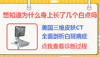 腰部有早期白癜风去唐山哪治疗效果好