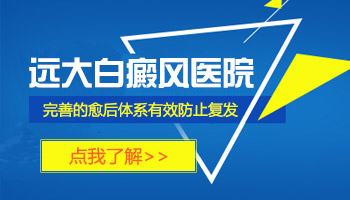 腿部长白癜风去廊坊哪看能治好