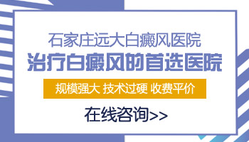 身上有大面积白癜风去承德哪治疗能治好