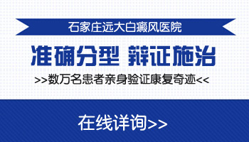 腰部有大片白癜风去廊坊哪看比较好