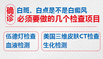 河北哪家医院治疗白癜风费用更低”