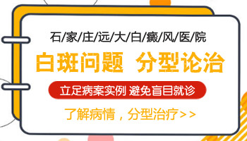 腰部有早期白癜风去唐山哪看效果好