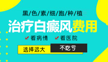 河北白癜风医院看病费用是多少