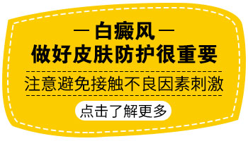 腿部长白癜风去承德哪看能治好”