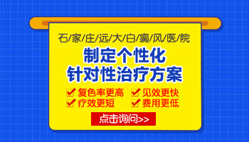 河北哪些医院治疗好白癜风专业 费用低