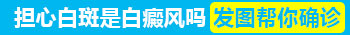 河北白癜风医院哪些治好白癜风更专业 价格便宜