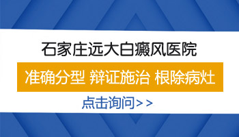 脖颈长白癜风去石家庄哪看效果好