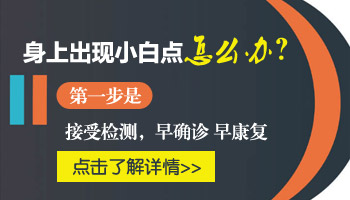 腹部有大面积白癜风去河北哪治疗效果好